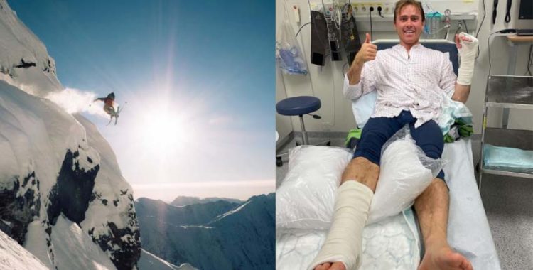 Nikolai Schirmer gick på näsan och krossade käkben, bröt arm och slet en hälsena. Ingen bra första skiddag. 