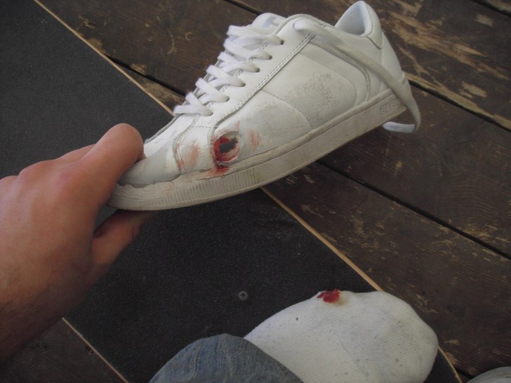 Märks när man både gör fel på skateboarden, o. Foto: Jonatan bergström. Åkare: Jonatan bergström.