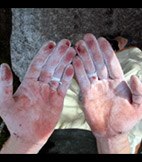 Ännu en dag av Abstines terapi. Foto: Dag Knutsson. Åkare: Johannes Nilsson.