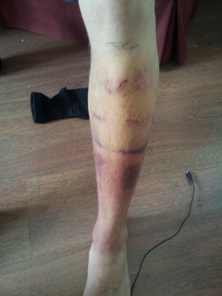 Efter en liten smäll. Foto: Andreas Isaksson. Åkare: Andreas Isaksson.