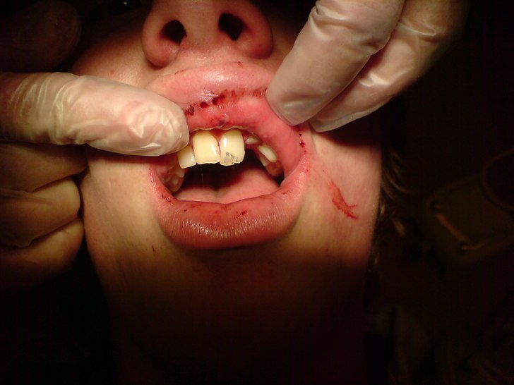 ah, de ser ju inte så bra ut kan man väl säga. . Åkare: Robin.