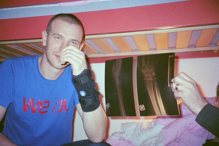 Anders med sina nytagna röntgenbilder.... Foto: Mats Kroona. Åkare: Anders Nilsson.