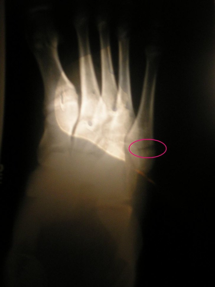 ONT .. Foto: jag, challe :P. Åkare: jag ...