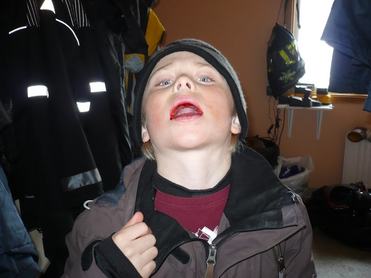 jag krarsai gesunda. Foto: brorsan. Åkare: jag.