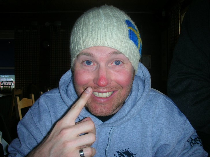 haha.. härlig bränna på snoken. Foto: Gustaf Säfström. Åkare: Eric Säfström.