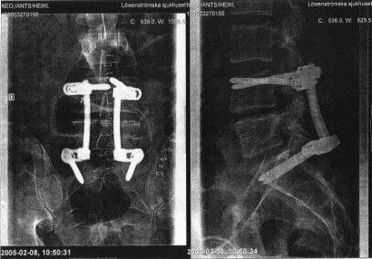 Foto: Dr Doktor. Åkare: Ants Neo.