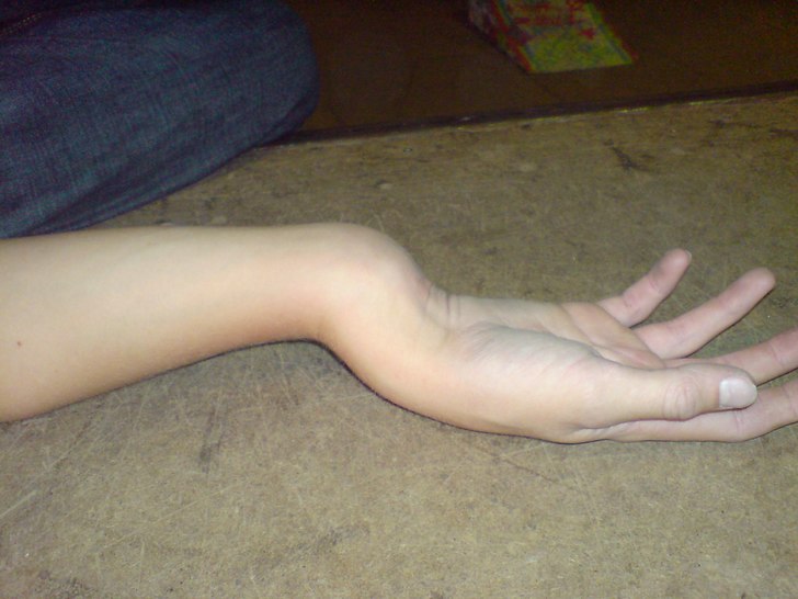 Oh snap. Foto: Simon Olsson. Åkare: Jonas Månsson.