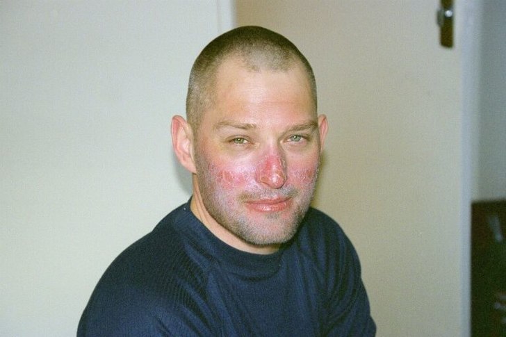 Kloka killar använder solskydd, hårda män låte. Foto: Pär Fritiofsson. Åkare: Peter Fritiofsson.