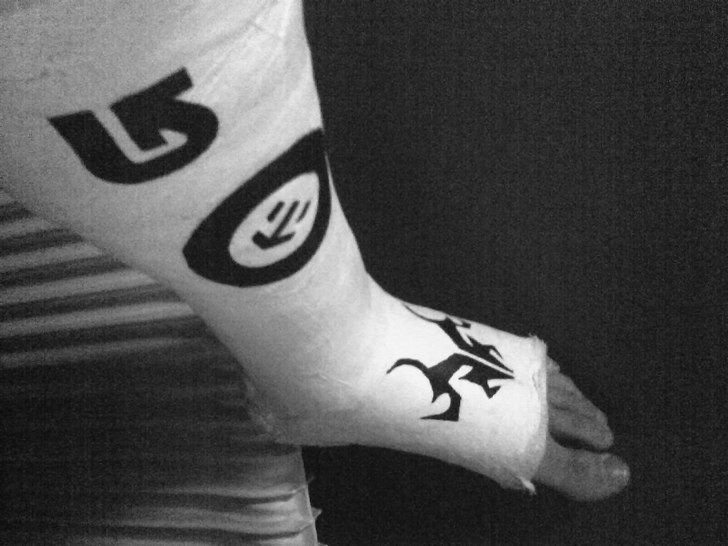 Brutit benet, hoppas jag hinner rehaba mej ordentl. Foto: ja. Åkare: ja.