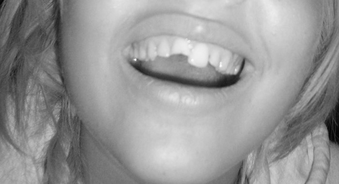 ouuscch :(.