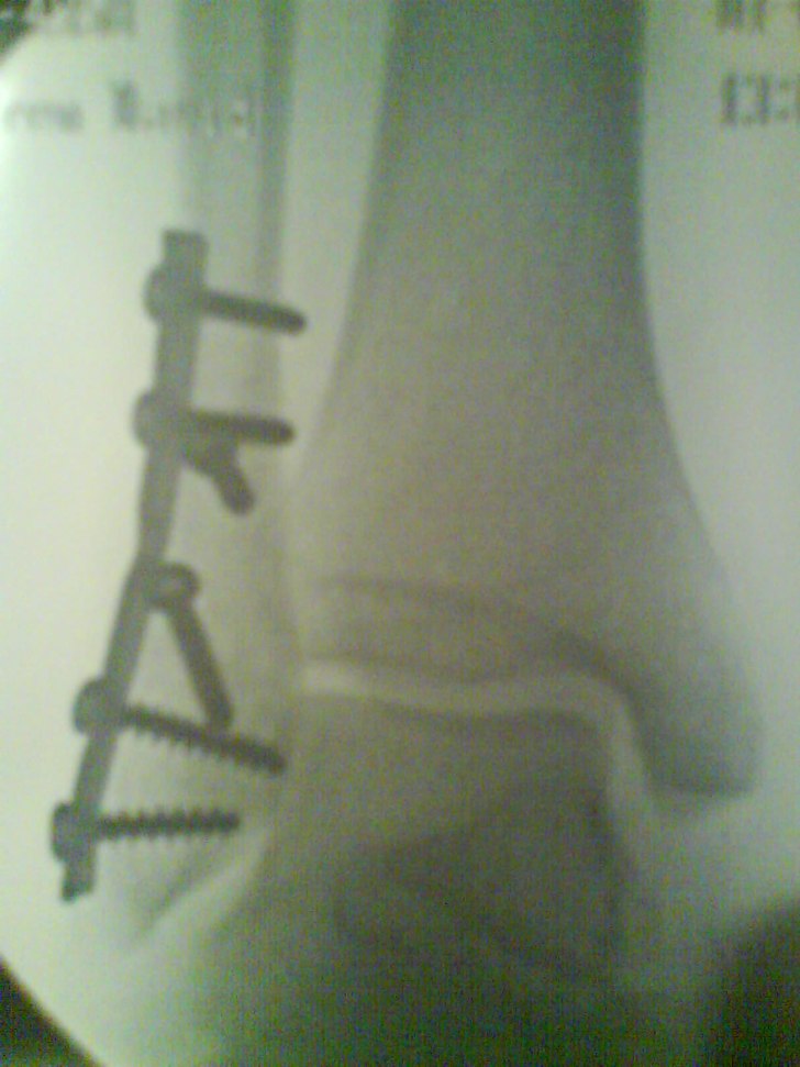 Efter ett misslyckat dropp. Åkare: David Askengren.