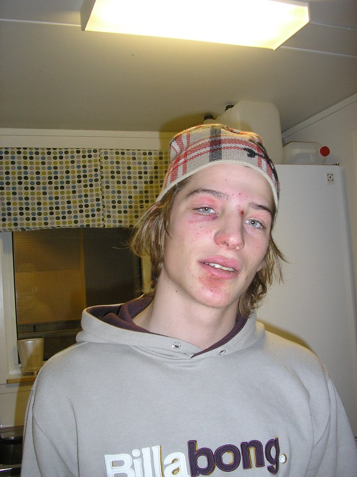 Efter en liten olycka med en luftslang som lossnad. Foto: Malin. Åkare: Håkan.