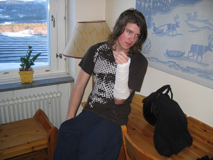 haha, mange bröt armen FÖRST dan andra ÅKET. Foto: Oskar tror ja. Åkare: Mange.