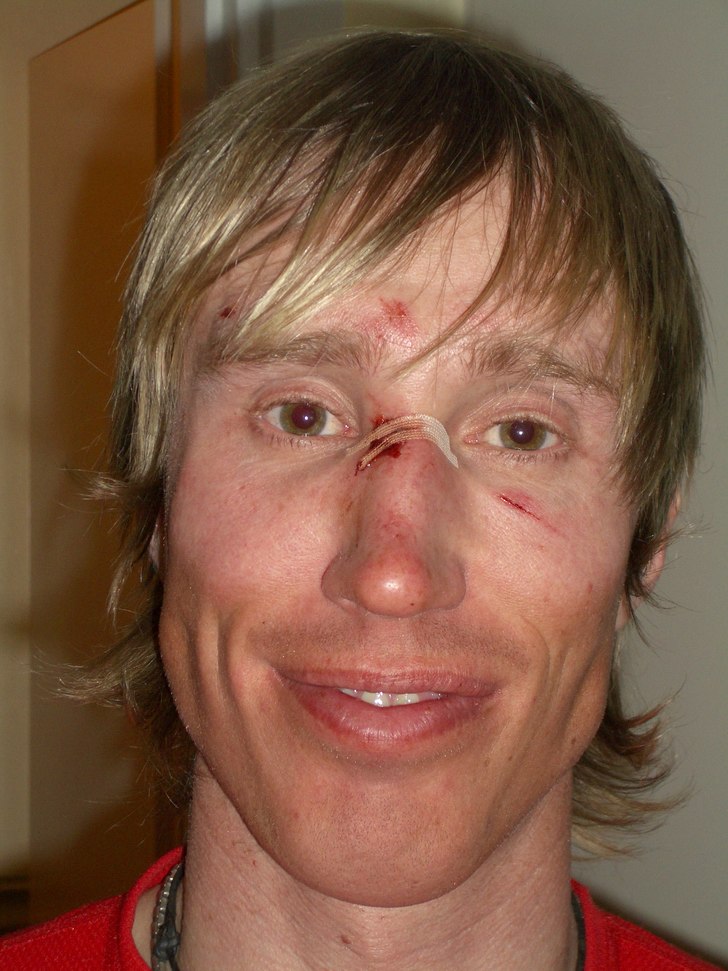 klassisk trädkramning en fin puder dag i kittel . Foto: Me my self. Åkare: pastorn.