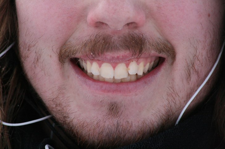 Skägg är det nya baggy!. Foto: Karl Green. Åkare: Jeppenator.