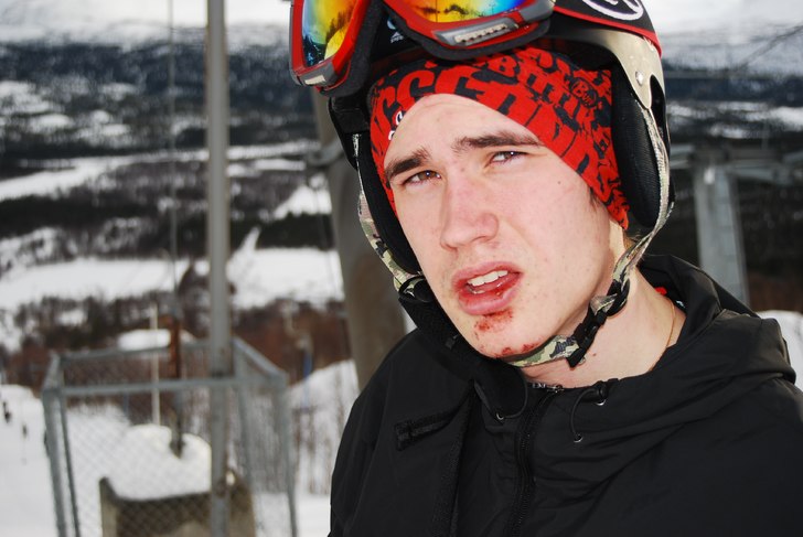 Vurpade lite och slog sönder munnen och hakan.. Foto: Andreas Källström. Åkare: Linus Nyström.