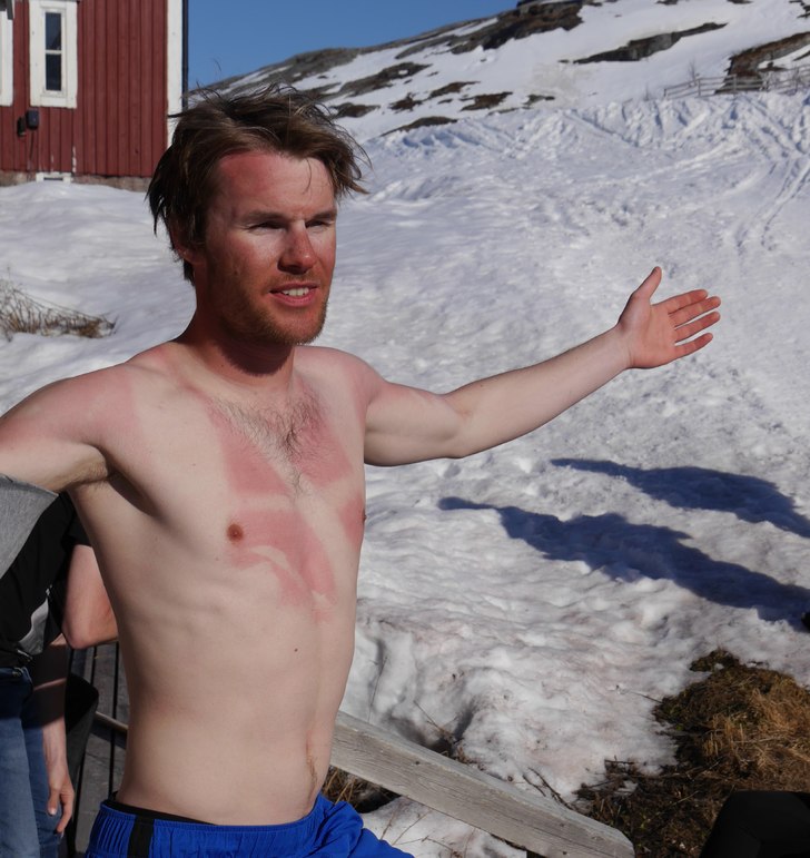 Såg ut som en dansk fotbollshuligan hela sommaren.