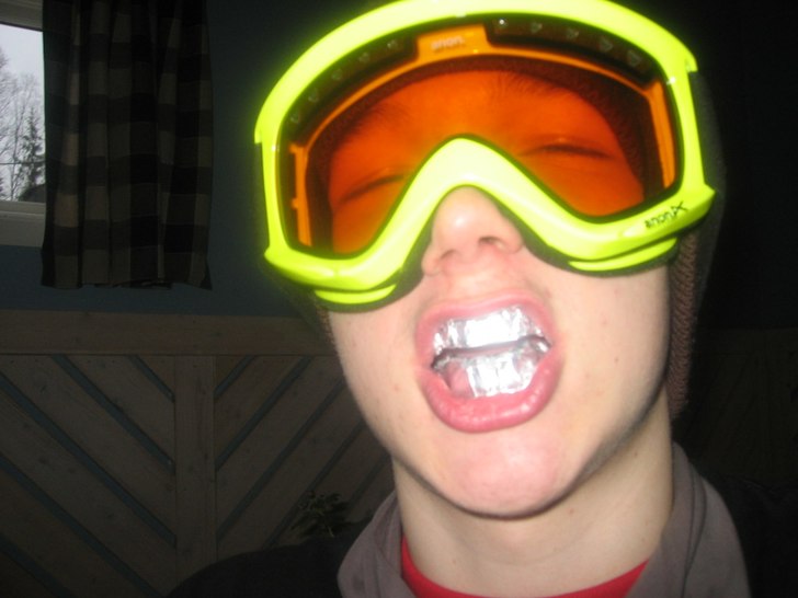 eric gör grillz av nån tuggumiförpackning:P. Foto: jaak. Åkare: eric johansson (kruxelidux).