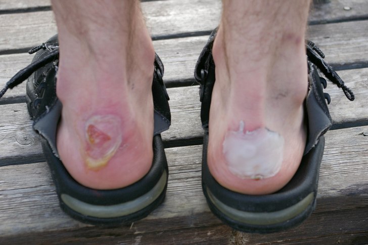 skoskav. Foto: björn. Åkare: bengt.