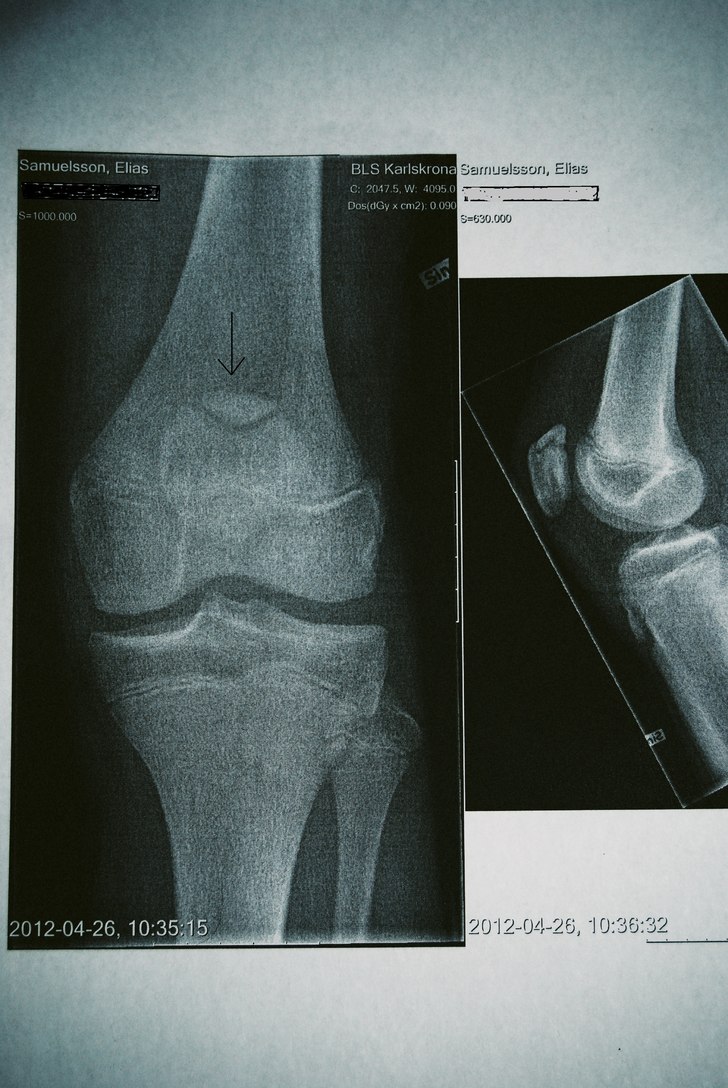 broken.
