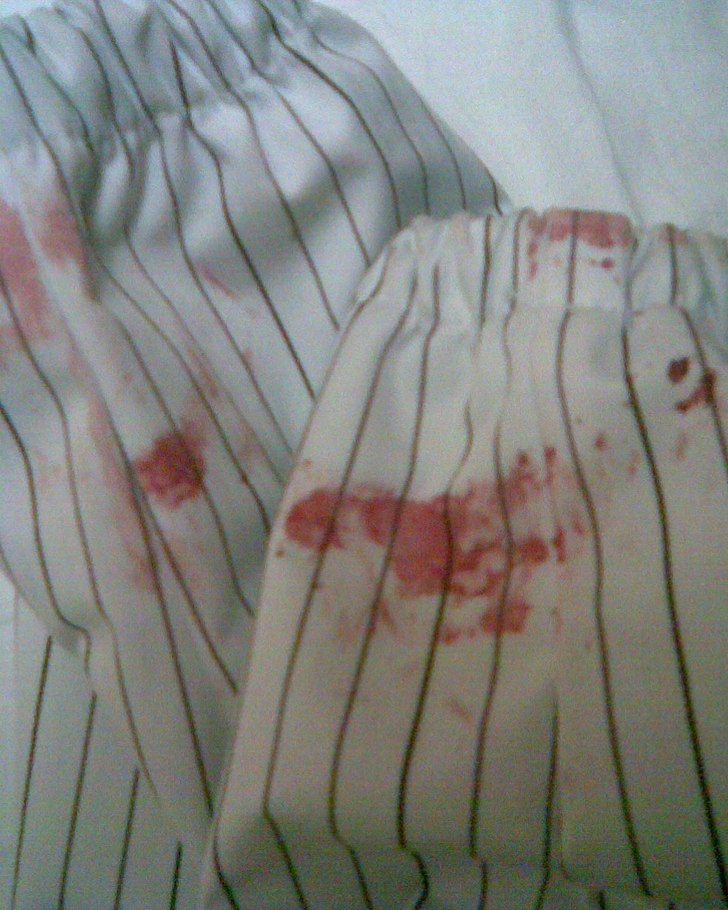 Så kan det gå.. . Foto: kLara. Åkare: klara.