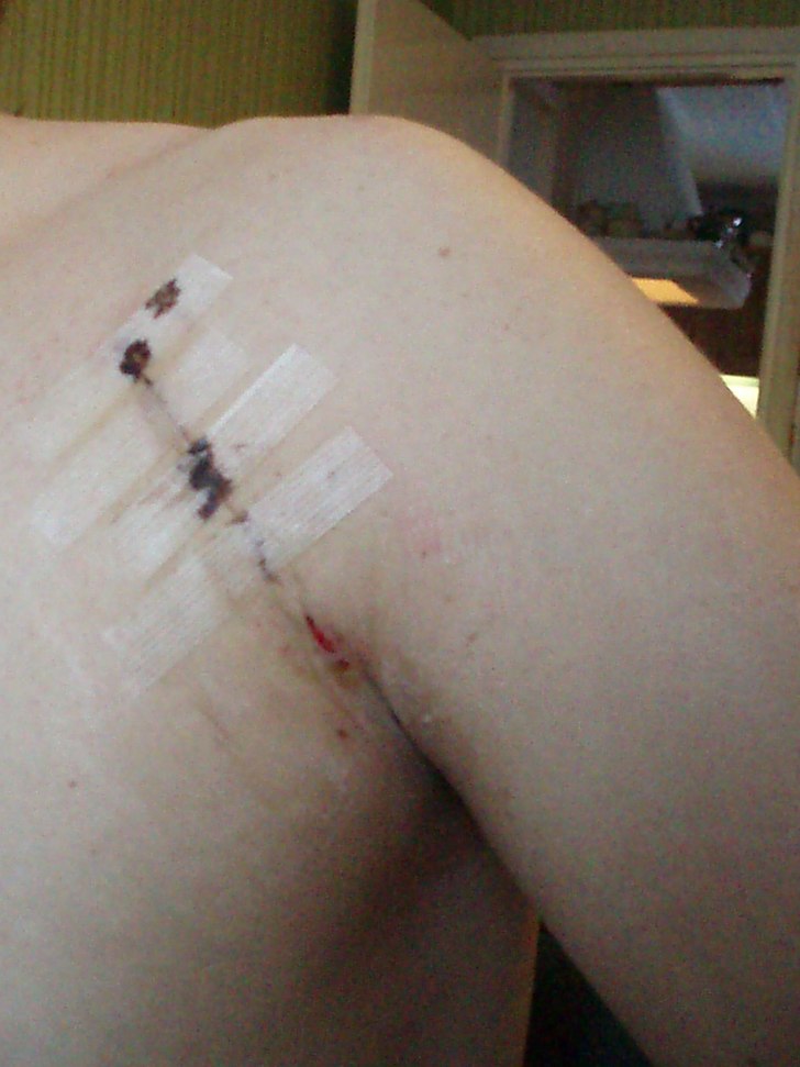 Så här går det om man inte landar på skidorna . Foto: Bobby Jaksas. Åkare: Henrik Thunborg.