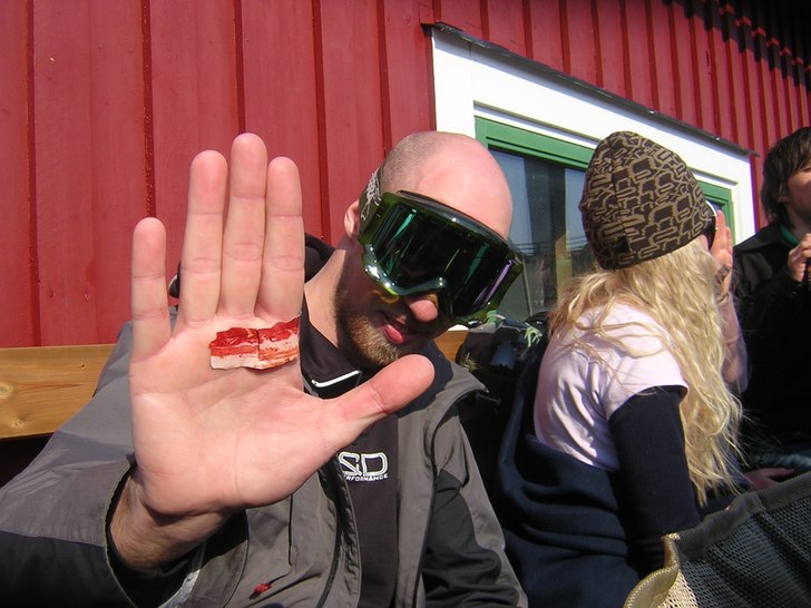 Erik är helnöjd över sitt baconplåster!!!!!. Foto: Martin hansson. Åkare: Erik.