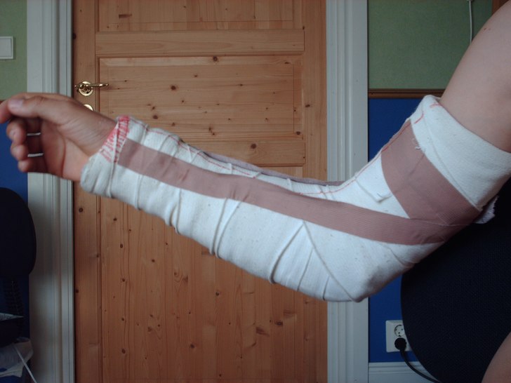 Så kan de gå när man klantar till de på studsm. Foto: Stativ. Åkare: Armen.