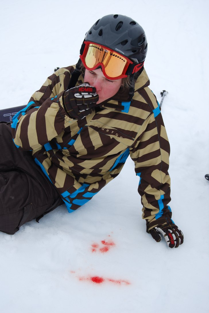 sånt händer när man slåss med lillebror. Foto: william tommila. Åkare: jens.
