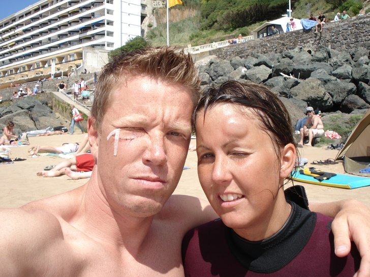 Team Injury. Jag har sytt ihop ansiktet efter att . Foto: Christian Johansson.