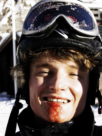 Det kostar i kropp.... Foto: David Samuelsson. Åkare: Christopher Beselin.