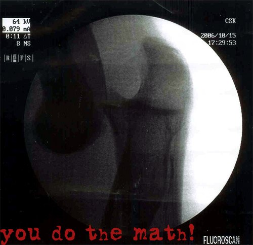 Min armbåge efter att ha landat på ett rail, med. Foto: Doktorn. Åkare: jag.