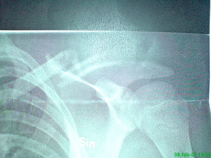 ovärt. Foto: Röntgenwoman. Åkare: mazter.