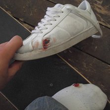 M&auml;rks n&auml;r man b&aring;de g&ouml;r fel p&aring; skateboarden, o. Foto: Jonatan bergstr&ouml;m. &Aring;kare: Jonatan bergstr&ouml;m.