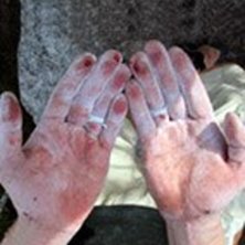 &Auml;nnu en dag av Abstines terapi. Foto: Dag Knutsson. &Aring;kare: Johannes Nilsson.