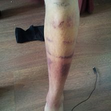 Efter en liten sm&auml;ll. Foto: Andreas Isaksson. &Aring;kare: Andreas Isaksson.