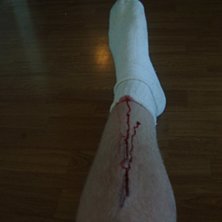 Foto: jag(kristian ohlsson). &Aring;kare: mitt ben..