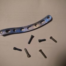 titanet som satt i min axel^. Foto: sez.