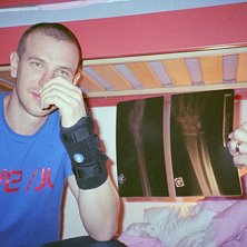 Anders med sina nytagna r&ouml;ntgenbilder.... Foto: Mats Kroona. &Aring;kare: Anders Nilsson.