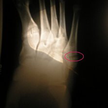 ONT .. Foto: jag, challe :P. &Aring;kare: jag ...