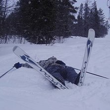 jag rammlade i liften och br&ouml;t b&aring;da armarna och . Foto: Jessika &Ouml;stlund. &Aring;kare: Gabriel Bergman:P.