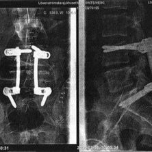 Foto: Dr Doktor. &Aring;kare: Ants Neo.
