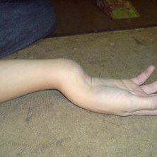 Oh snap. Foto: Simon Olsson. &Aring;kare: Jonas M&aring;nsson.