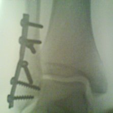 Efter ett misslyckat dropp. &Aring;kare: David Askengren.