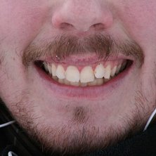 Sk&auml;gg &auml;r det nya baggy!. Foto: Karl Green. &Aring;kare: Jeppenator.