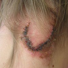 ett litet l&auml;tt s&aring;r efter en liten l&auml;tt vurpa.... Foto: derik. &Aring;kare: vitor karlssen.