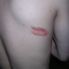 Kunde inte staka p&aring; en vecka efter den trappan.. Foto: Micke &amp;#039;fot&amp;#039; Hjortholt. &Aring;kare: Oscar Molin.