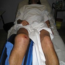 Under sn&ouml;n finns det sten.... Foto: Sofia Bergstr&ouml;m. &Aring;kare: Per Sparrings.