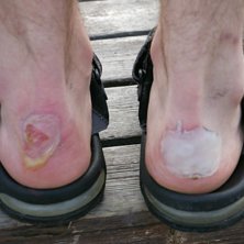 skoskav. Foto: bj&ouml;rn. &Aring;kare: bengt.