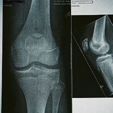 broken.